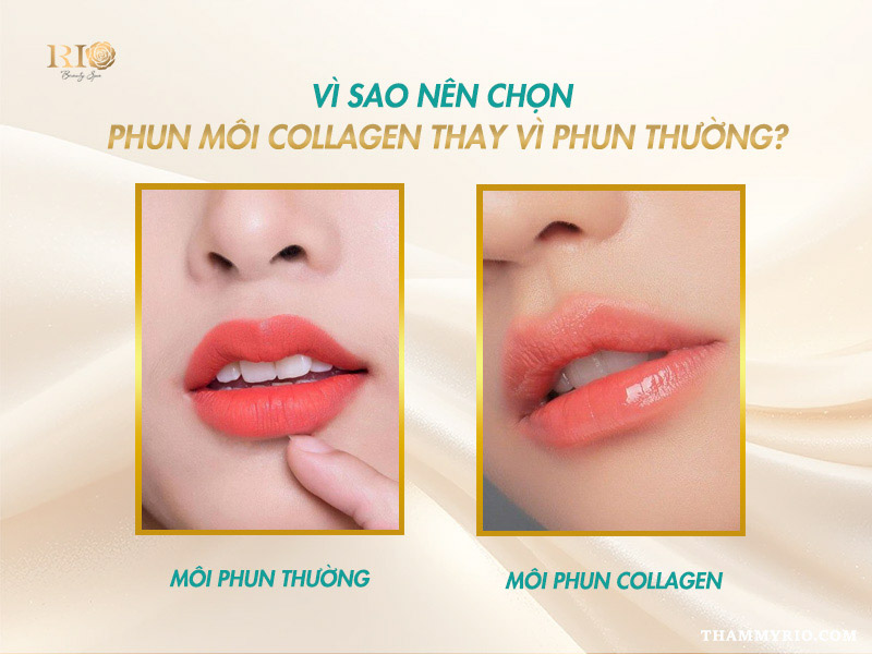 Phun Môi Collagen Màu Cam Đào – Giữ Màu Lâu, Tôn Da Rạng Rỡ 4 Vì sao nên chọn phun môi collagen màu cam đào thay vì phun thường?