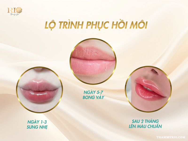 Phun Môi Collagen Màu Cam Đào – Giữ Màu Lâu, Tôn Da Rạng Rỡ 7 Lộ trình phục hồi sau phun môi collagen màu cam đào
