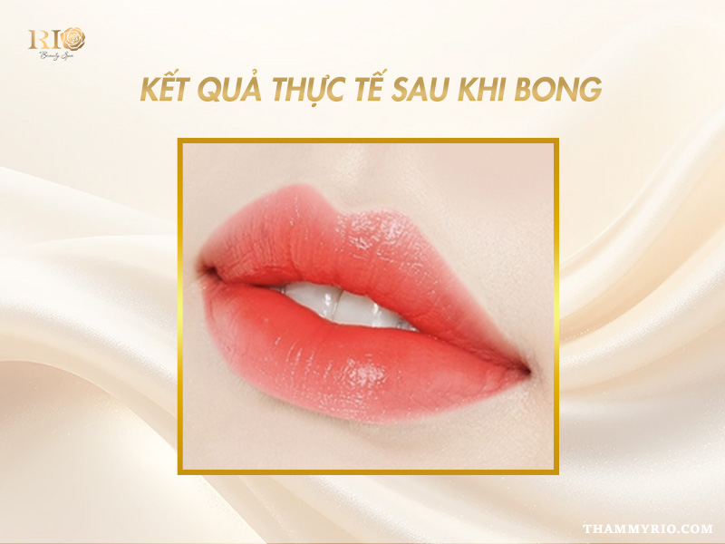 Phun Môi Collagen Màu Cam Đào – Giữ Màu Lâu, Tôn Da Rạng Rỡ 12 Hình ảnh khách hàng trước và sau khi phun môi collagen màu cam đào