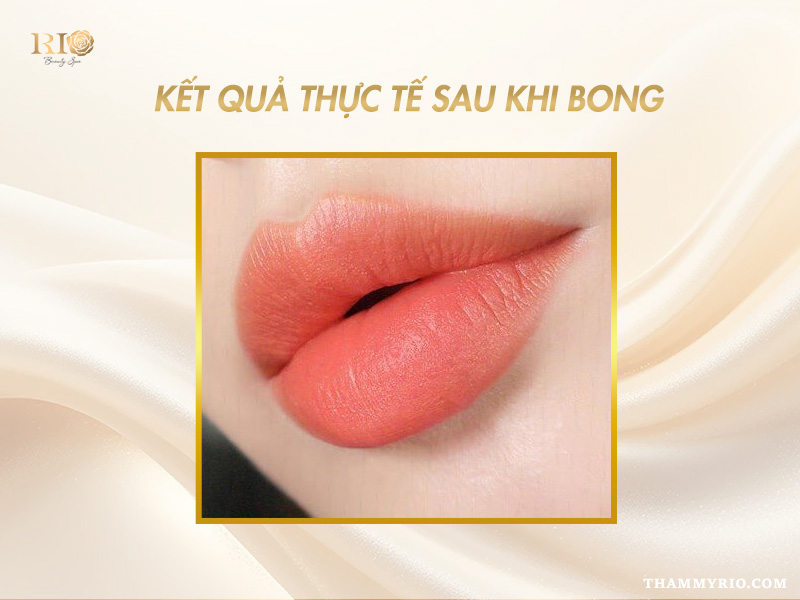 Phun Môi Collagen Màu Cam Đào – Giữ Màu Lâu, Tôn Da Rạng Rỡ 11 Cận cảnh môi sau khi phun collagen màu cam đào, không bị viền, màu sắc hài hòa và bền đẹp