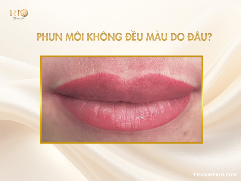 Phun môi không đều màu do đâu và nguyên nhân thường gặp