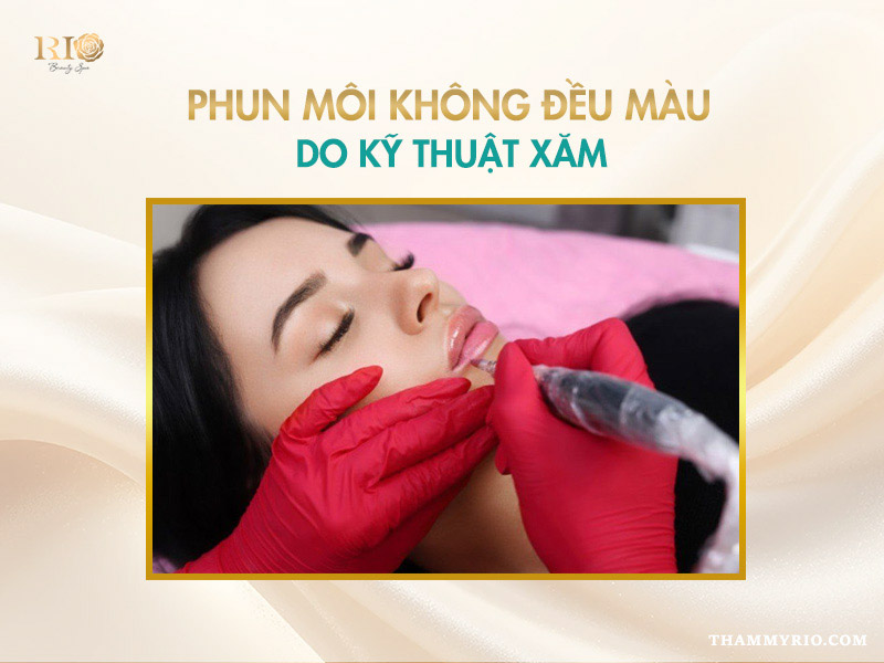 Phun môi không đều màu do kỹ thuật xăm không chuẩn