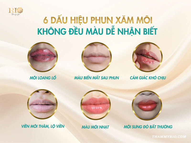 Biểu hiện phun môi không đều màu dễ nhận biết