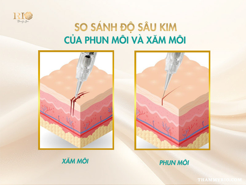 So sánh độ sâu kim: Yếu tố cốt lõi trả lời phun môi khác xăm môi chỗ nào
