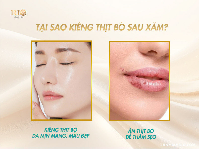 Xăm ăn thịt bò có sao không? Nguy cơ sẹo lồi và thâm sạm sau xăm