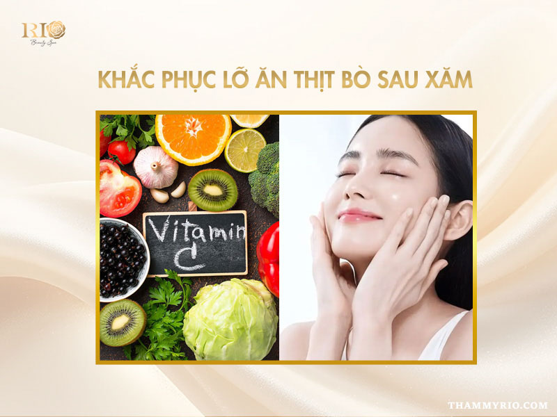 Khắc phục lỡ xăm ăn thịt bò bằng cách bổ sung Vitamin C và Kẽm