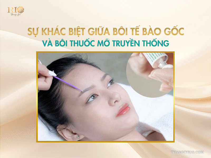 Sự khác biệt giữa bôi tế bào gốc và bôi thuốc mỡ truyền thống