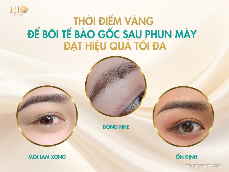 Thời điểm vàng để bôi tế bào gốc sau phun mày đạt hiệu quả tối đa
