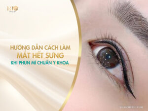 Hướng dẫn cách làm mắt hết sưng khi phun mí chuẩn y khoa