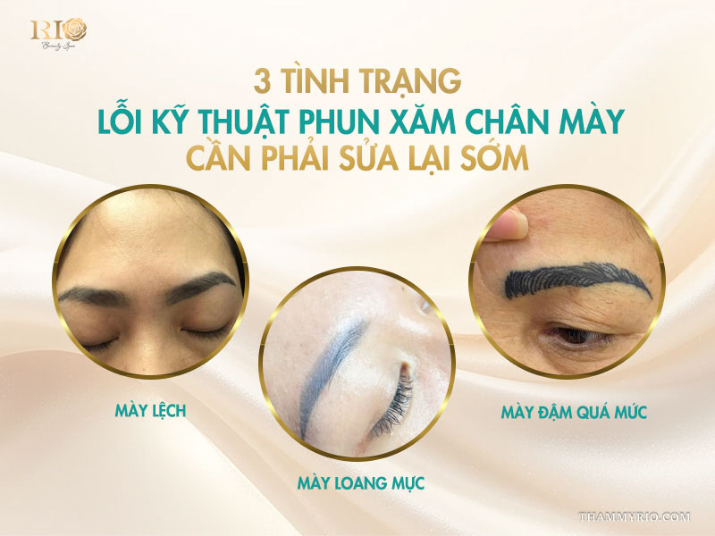  3 tình trạng lỗi kỹ thuật phun xăm chân cần phải sửa lại sớm