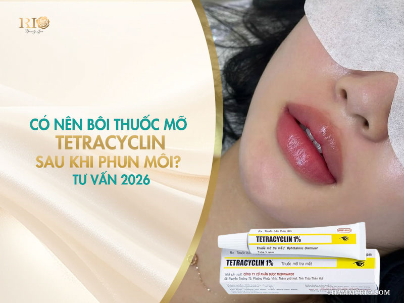 Có nên bôi thuốc mỡ Tetracyclin sau khi phun môi? Tư vấn 2026