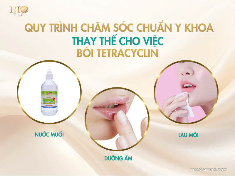 Quy trình chăm sóc chuẩn y khoa thay thế cho việc bôi Tetracyclin