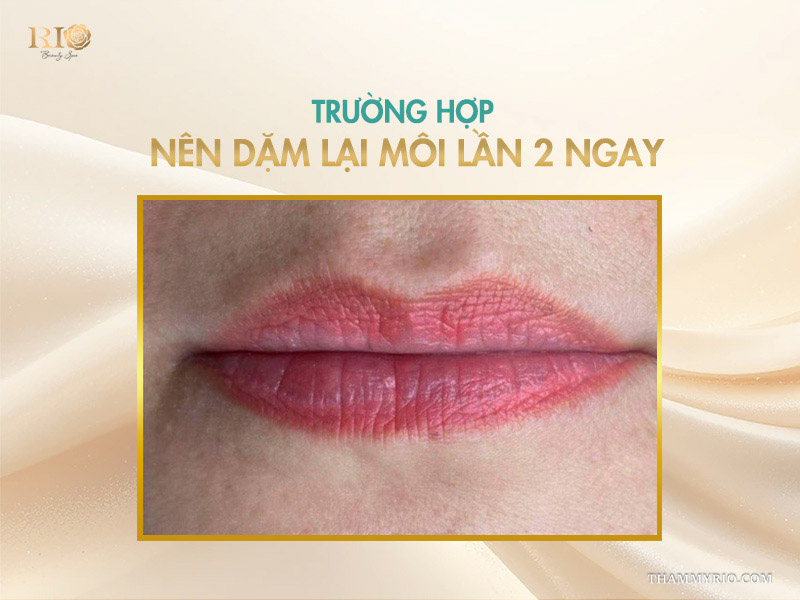 Có nên dặm lại môi lần 2 không? Khi nào nên dặm lại 4 Trường hợp nên dặm lại môi lần 2 ngay