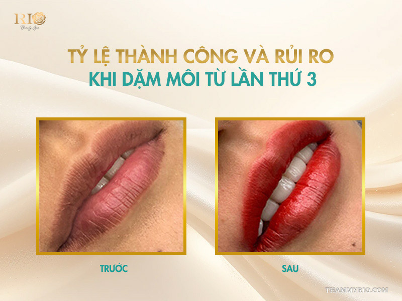 Có nên dặm lại môi lần 3 để cải thiện màu? 4 Tỷ lệ thành công và rủi ro khi dặm môi từ lần thứ 3
