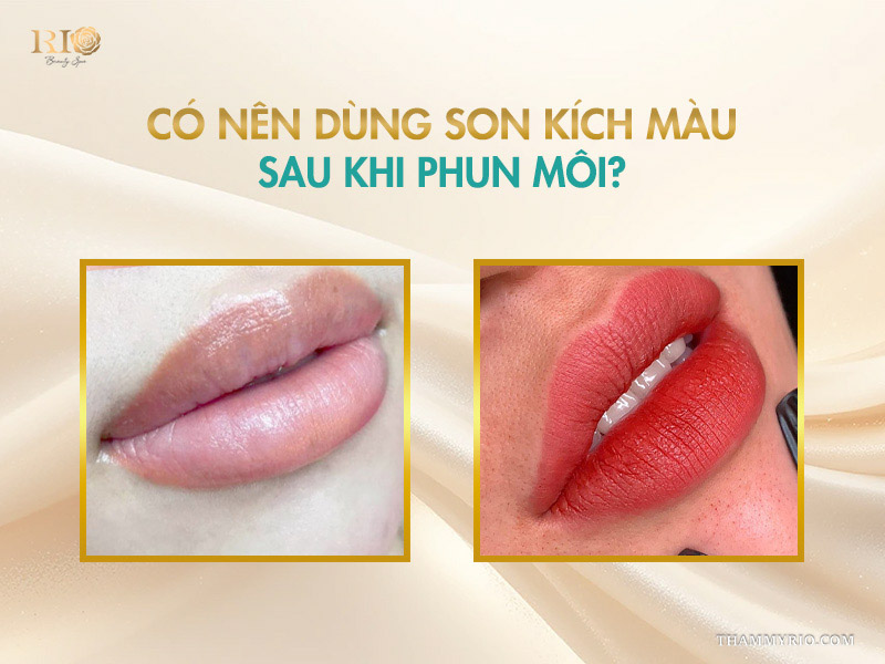 Có nên dùng son kích màu sau khi phun môi?