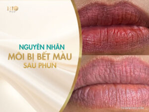 Môi bị bết màu