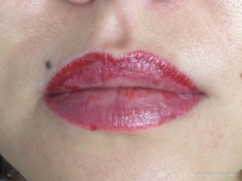 Hình ảnh thực tế của tình trạng môi bị loang màu