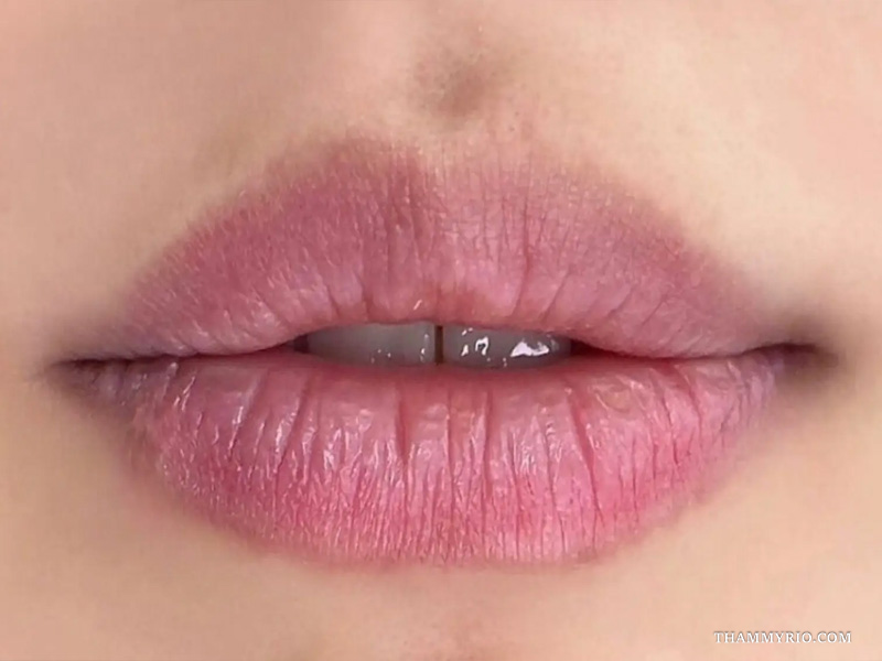 Hình ảnh thực tế của tình trạng môi bị loang màu