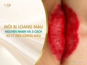 Môi bị loang màu: nguyên nhân và 5 cách xử lý môi loang màu