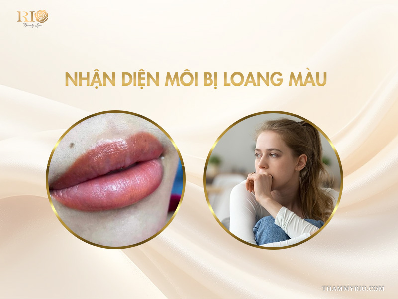  Nhận diện môi bị loang màu 