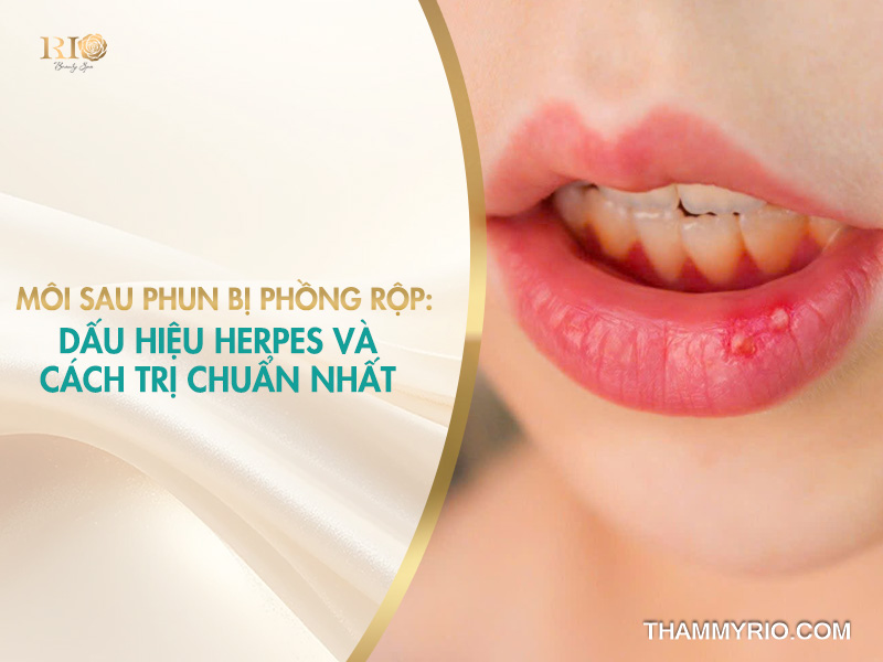 Môi sau phun bị phồng rộp: Dấu hiệu xăm môi bị herpes và cách trị chuẩn