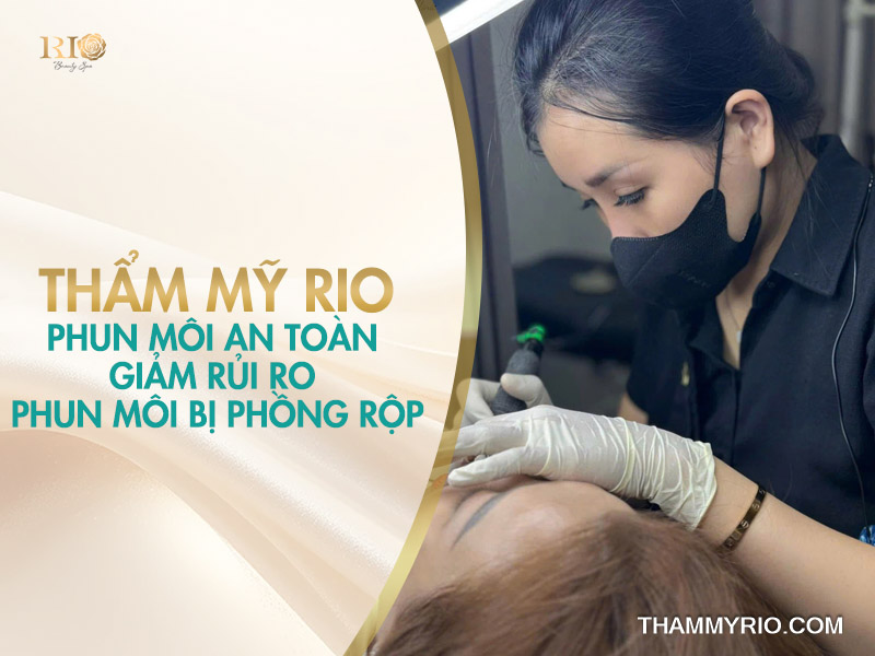 Thẩm mỹ Rio phun môi an toàn giảm rủi ro phun môi bị phồng rộp