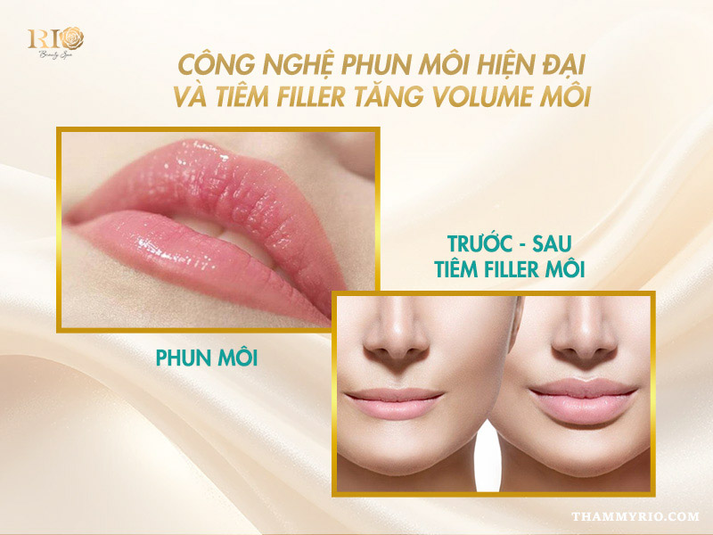 Nên phun môi trước hay tiêm filler trước? Định nghĩa phun môi và tiêm filler