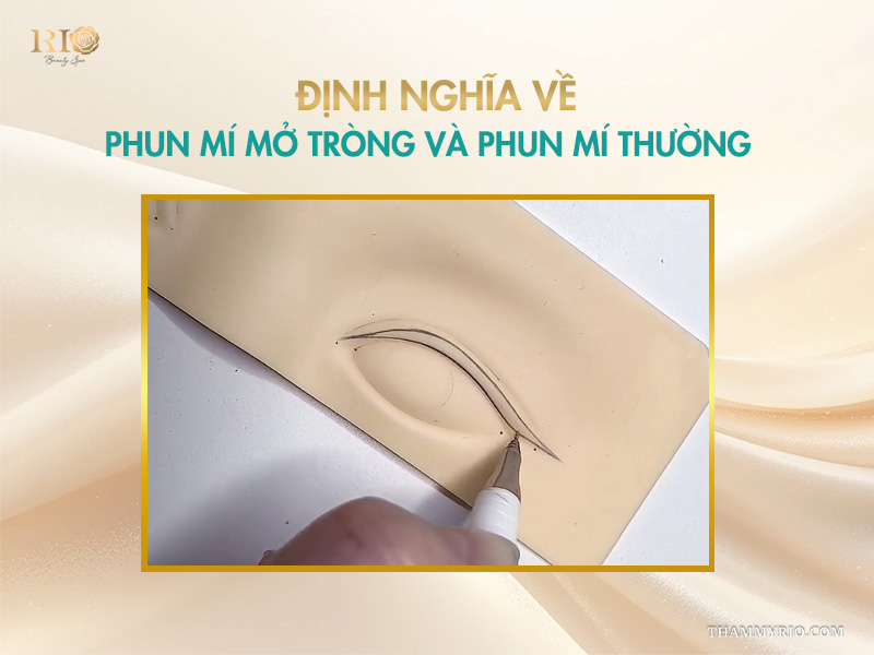Định nghĩa về phun mí mở tròng và phun mí thường
