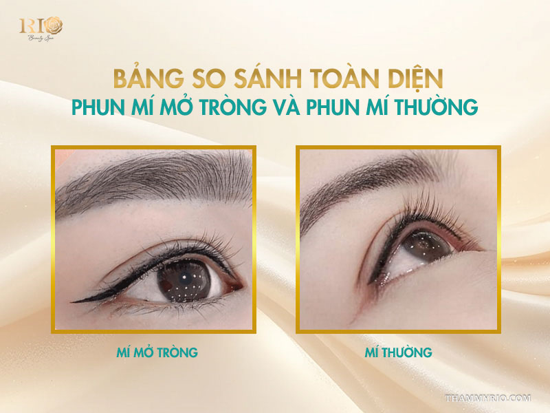 Bảng so sánh toàn diện phun mí mở tròng và phun mí thường 