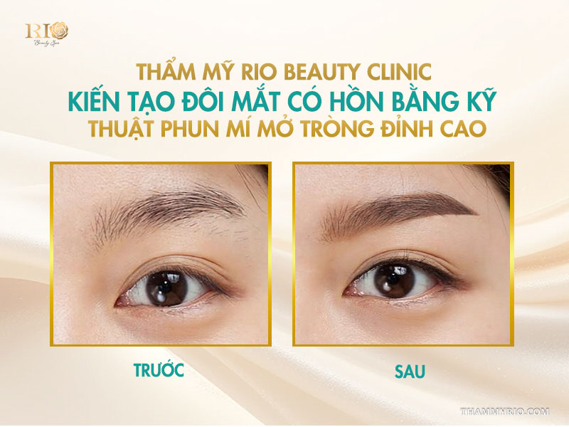 Hình thực tế từ khách hàng đã trải nghiệm phun mí mở tròng và phun mí thường tại Rio