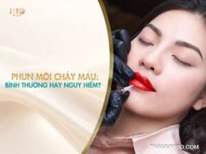 Phun môi chảy máu có sao không: Bình thường hay nguy hiểm?