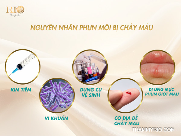 Phun môi bị chảy máu có sao không? Dấu hiệu nguy hiểm nên biết 3 5 nguyên nhân phổ biến khiến phun môi bị chảy máu