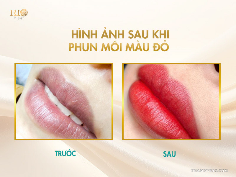 Hình ảnh sau khi phun môi màu đỏ tại Thẩm mỹ Rio Beauty Clinic 