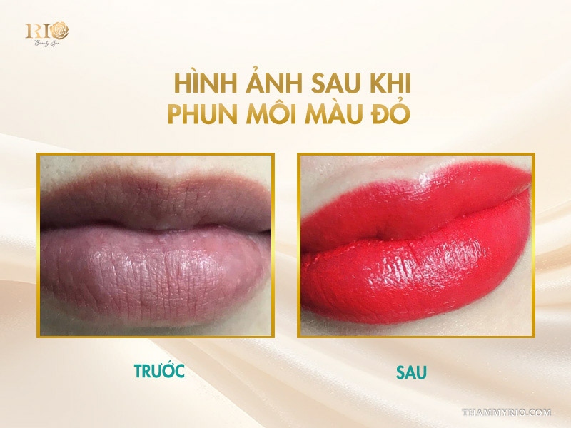 Hình ảnh sau khi phun môi màu đỏ tại Thẩm mỹ Rio Beauty Clinic 