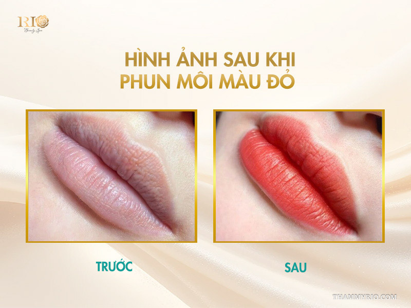 Hình ảnh sau khi phun môi màu đỏ tại Thẩm mỹ Rio Beauty Clinic 