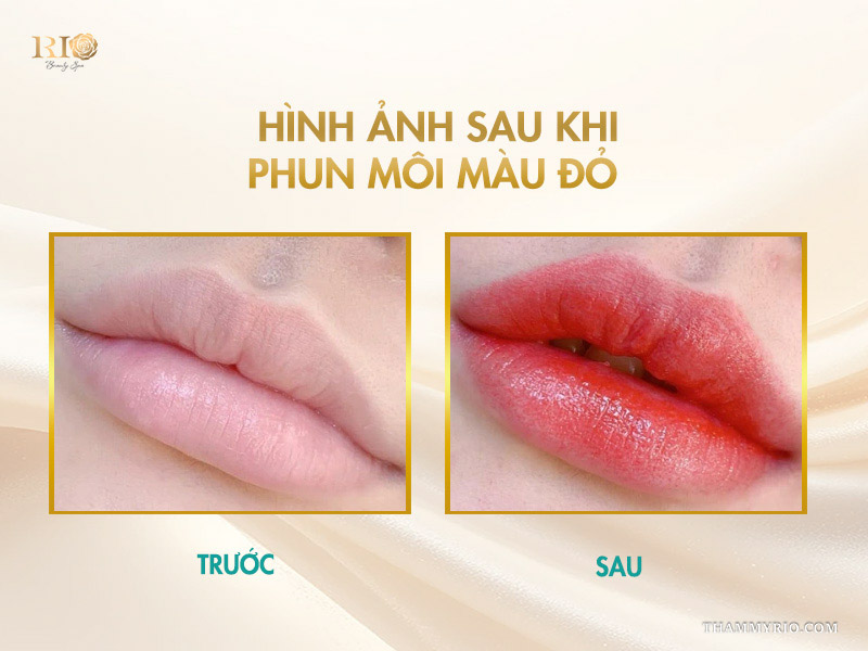 Hình ảnh sau khi phun môi màu đỏ tại Thẩm mỹ Rio Beauty Clinic 