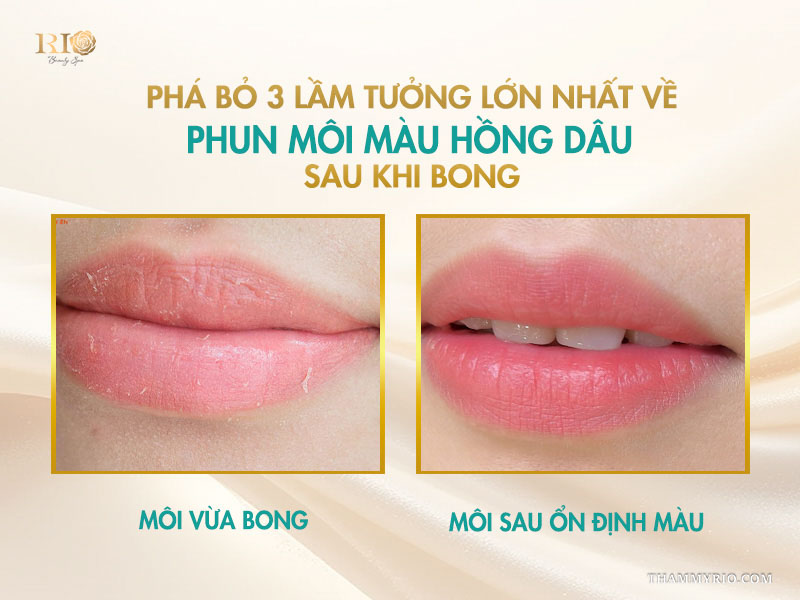Phá bỏ 3 lầm tưởng lớn nhất về phun môi màu hồng dâu sau khi bong
