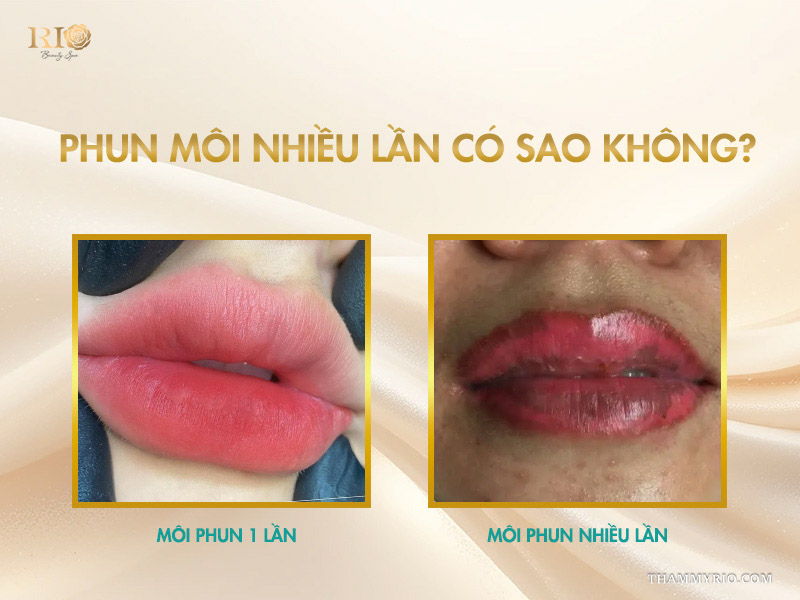  Phun môi nhiều lần có sao không?