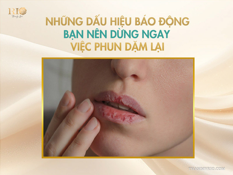 Những dấu hiệu báo động bạn nên dừng ngay việc phun dặm lại