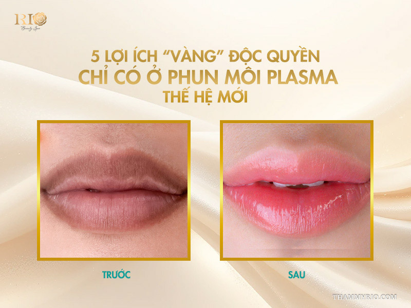 5 lợi ích tuyệt vời của công nghệ phun môi Plasma  3 5 lợi ích “vàng” độc quyền chỉ có ở phun môi Plasma thế hệ mới