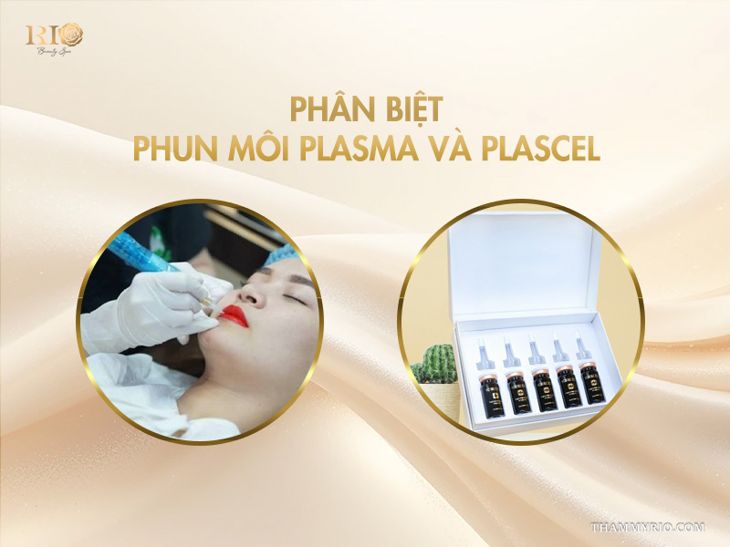 5 lợi ích tuyệt vời của công nghệ phun môi Plasma  5 Phân biệt phun môi Plasma và Plascell