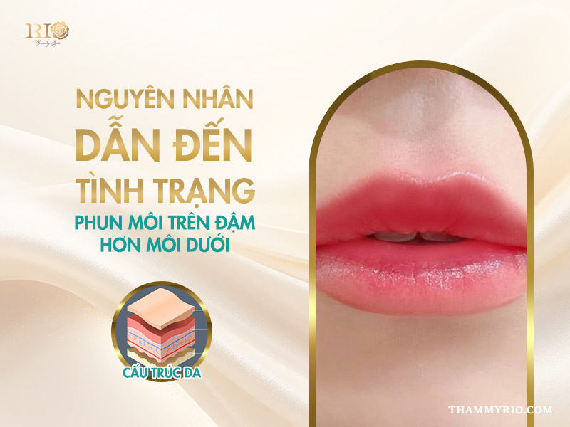 Nguyên nhân dẫn đến tình trạng phun môi trên đậm hơn môi dưới