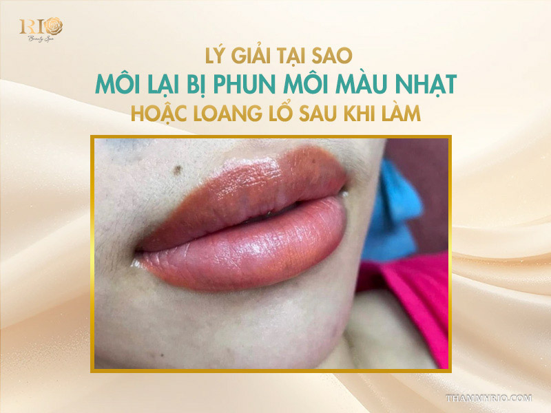Lý giải tại sao môi lại bị phun môi màu nhạt hoặc loang lổ sau khi làm
