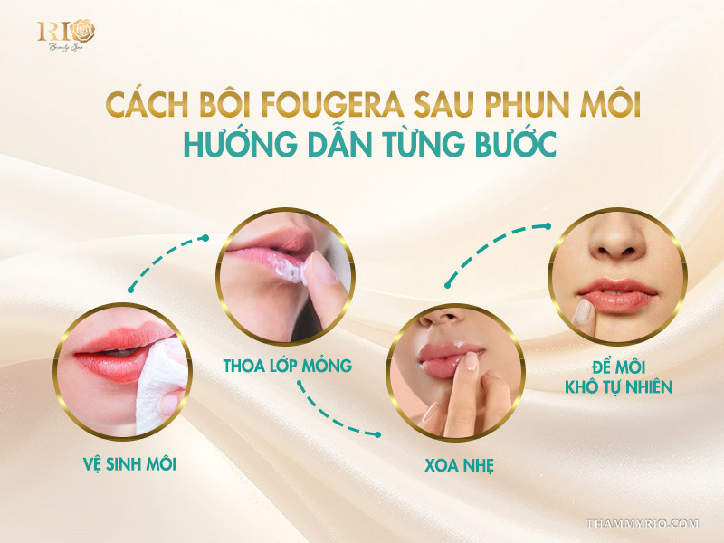 Thuốc Fougera là gì? Hướng dẫn sử dụng an toàn và hiệu quả 5 Cách bôi Fougera sau phun môi