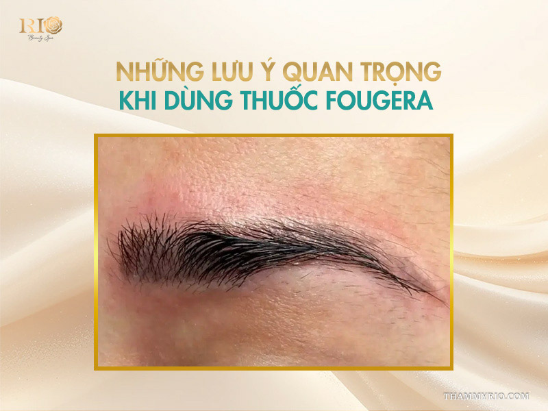 Thuốc Fougera là gì? Hướng dẫn sử dụng an toàn và hiệu quả 7 Những lưu ý quan trọng khi dùng thuốc Fougera
