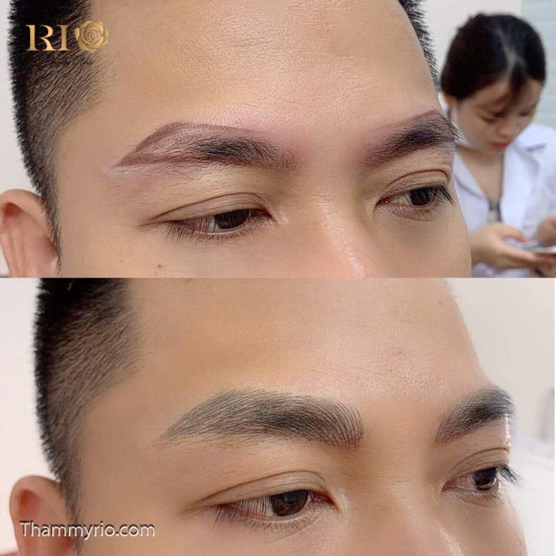 Kết quả xăm chân mày nam cho khách hàng không có lông mày bẩm sinh, thực hiện bằng kỹ thuật điêu khắc phong thủy tại Rio Beauty Clinic để tạo diện mạo mới đầy nam tính.