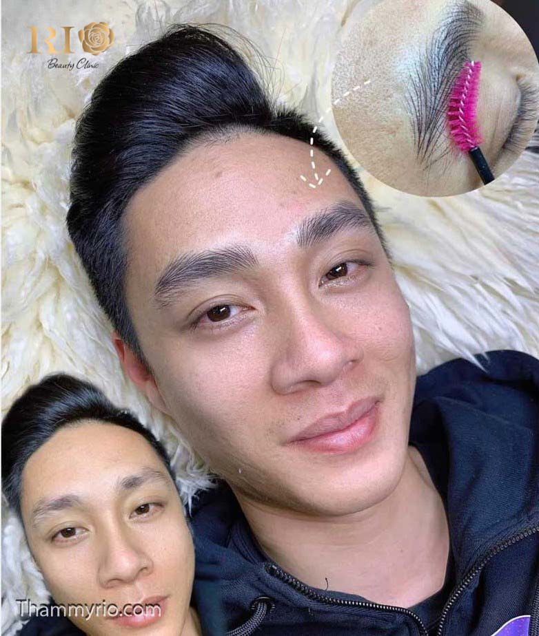 Hình ảnh so sánh trước và sau khi xăm chân mày cho nam giới tại Rio Beauty Clinic, khách hàng nam nở nụ cười hài lòng với đôi lông mày sắc nét, nam tính.