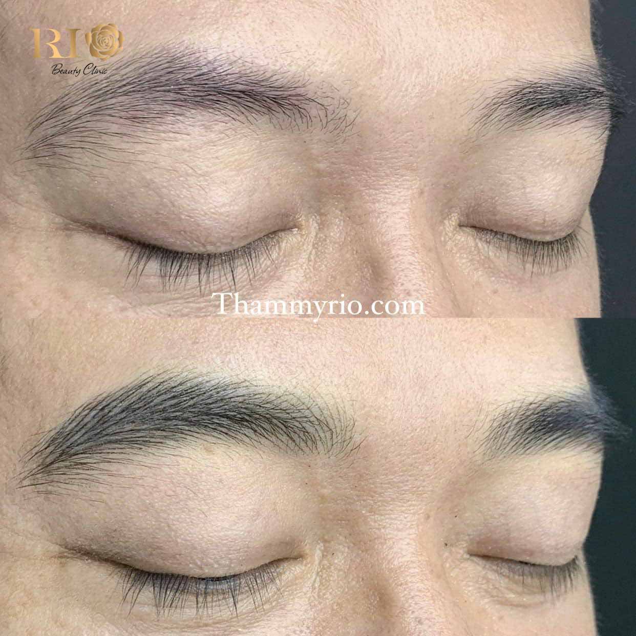 Khách hàng nam rạng rỡ hạnh phúc sau khi thực hiện xăm chân mày nam tại Rio Beauty Clinic, gương mặt bừng sáng và tự tin hơn với hàng lông mày mới.