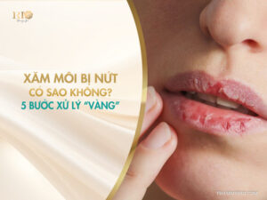 Khoảng thời gian vàng giữa các lần phun môi để đảm bảo an toàn