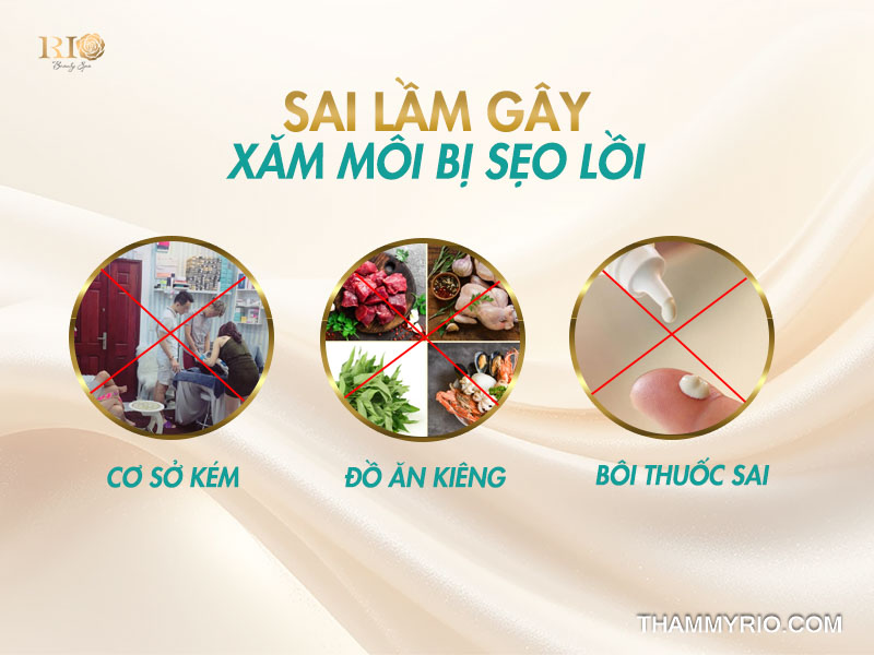 Sai lầm gây xăm môi bị sẹo lồi